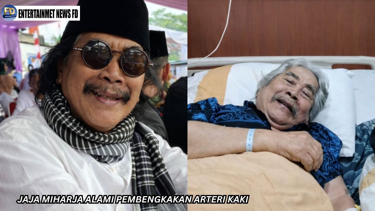 Jaja Miharja Alami Pembengkakan Arteri Kaki